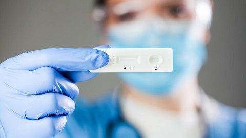 test antigenos comunidad feb 2021