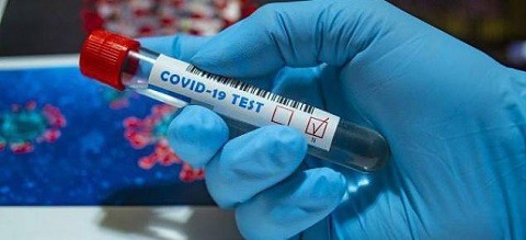 Este miércoles pueden ir a hacerse el test coronavirus todos los vecinos de Torrejón de Ardoz, independientemente del apellido que tengan test coronavirus